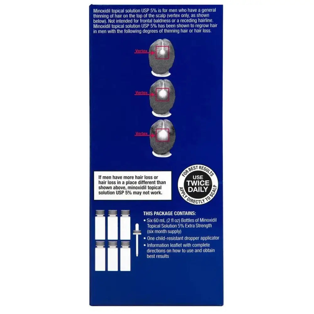 Members Mark 5% Minoxidil Topical Solution – 1–12 Month Supply (Canada) - NORTHWEST DEALS
